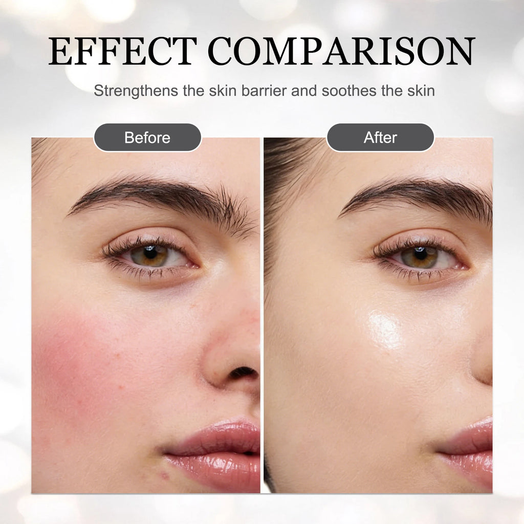 Centella & Niacinamide Serum أمبول السنتيلا والنياسيناميد